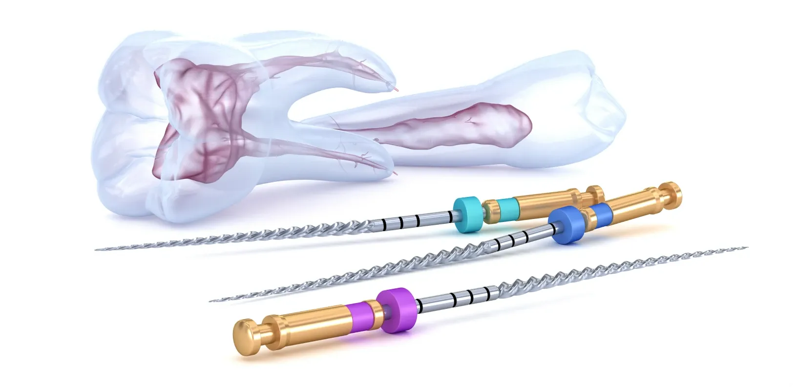 Endodontie : traitements au Cabinet dentaire des Docteurs DSW à Seclin